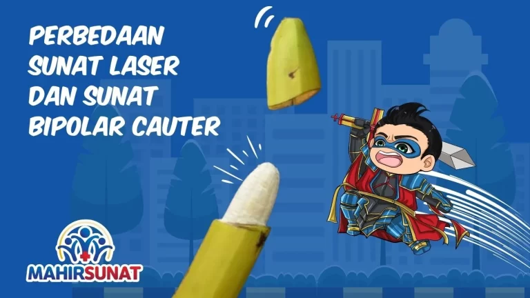 Perbedaan Sunat Laser dan Bipolar Cauter